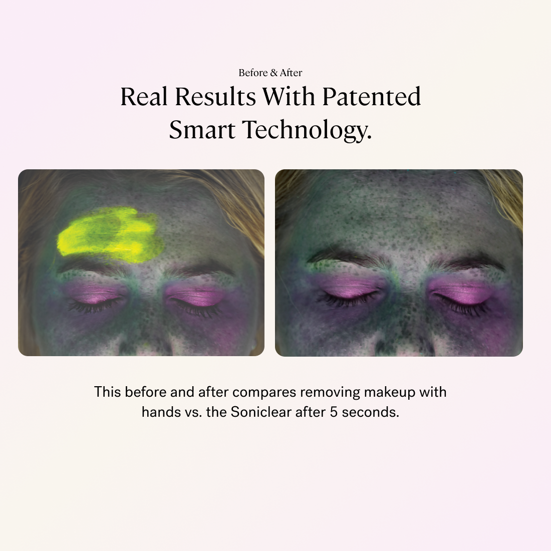 Experience real results with the Michael Todd Beauty 2-Piece Best Sellers Kit's patented smart technology, unveiling a radiant complexion.