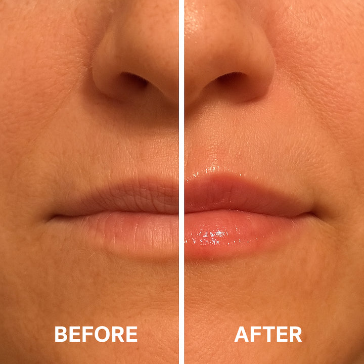 Split image showing lips and surrounding skin: left labeled