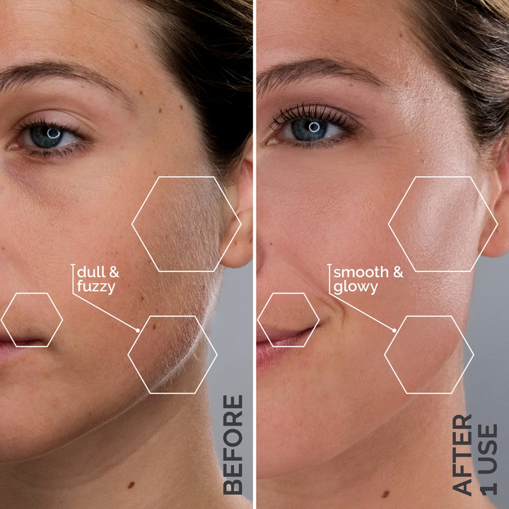 2 Month Supply . Side-by-side comparison of a woman's face showing 