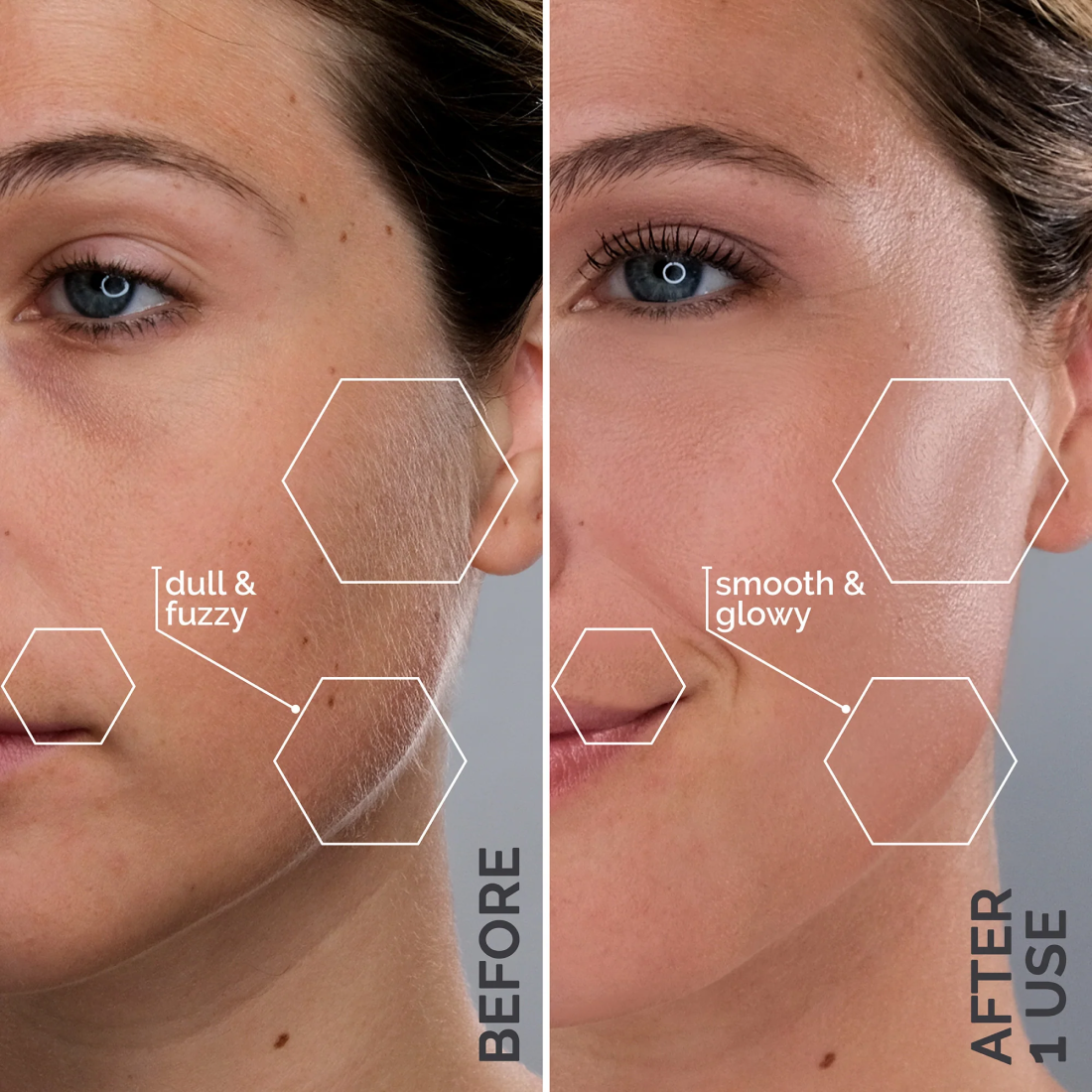 Lavender Lust .Close-up comparison of a woman's face showing skin texture before and after using Michael Todd Beauty's 4 in 1 Dermaplaning & Post Treatment System, with marked improvements in smoothness and glow.