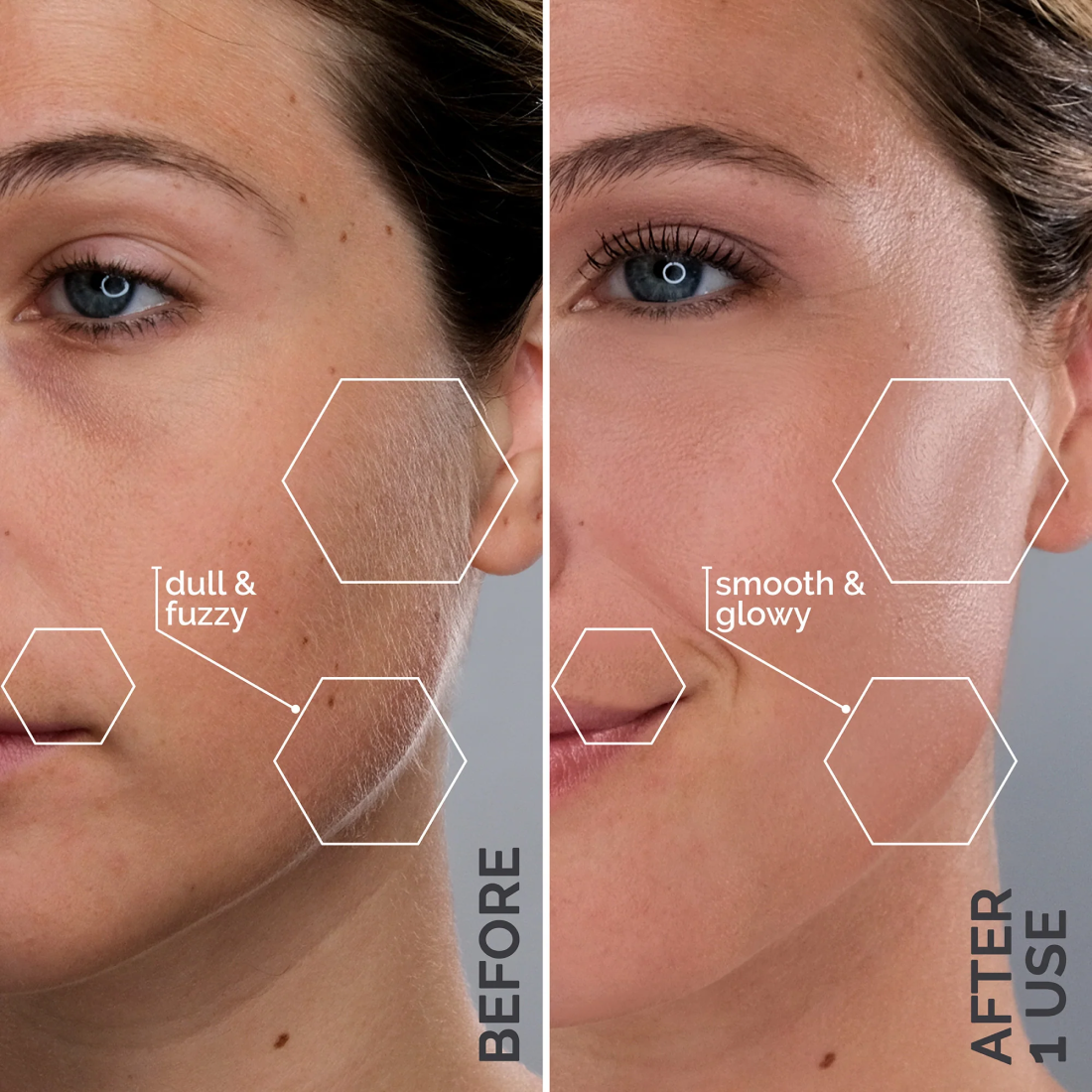 Split image of a woman’s face before and after using the Michael Todd Beauty Sonicsmooth Pro+ System—left side appears dull with visible texture ("before"), while the right looks smoother and more radiant ("after use").
