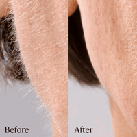 Sonicsmooth Clear Refill Tips