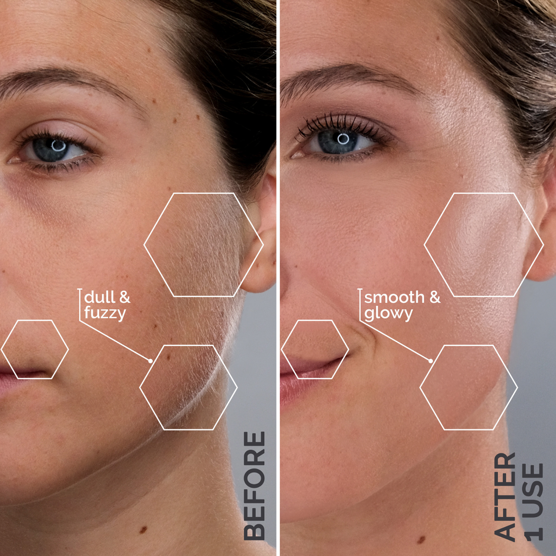 Before and after photos of a woman's face showcasing her radiant complexion after using Michael Todd Beauty's 2-Piece Best Sellers Kit.
